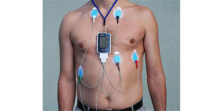 Holter-monitor